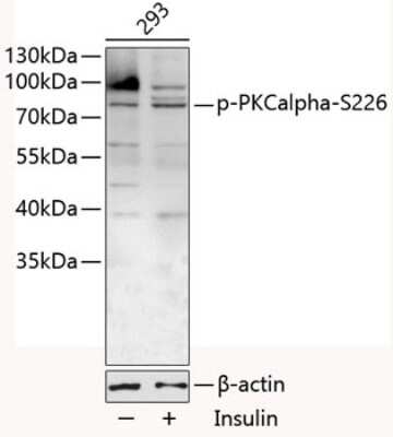 Western Blot: PKC alpha [p Ser226] Antibody [NBP3-05437] - Western blot analysis of extracts of 293 cells, using PKC alpha antibody (NBP3-05437) at 1:1000 dilution. 293T cells were treated by Insulin (100nM) for 10 minutes after serum-starvation overnight. Secondary antibody: HRP Goat Anti-Rabbit IgG (H+L) at 1:10000 dilution. Lysates/proteins: 25ug per lane. Blocking buffer: 3% BSA.